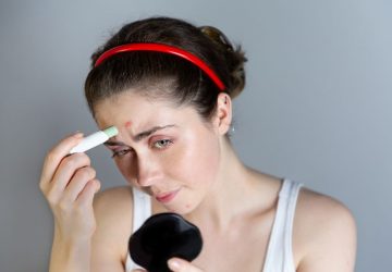 Rote Pickel gekonnt abdecken