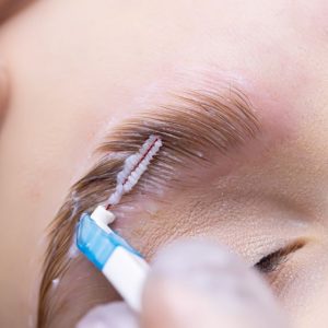 Brow Lifting