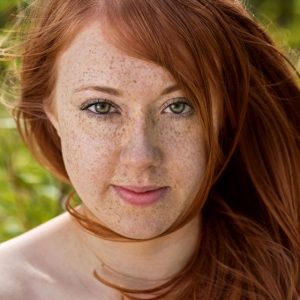 Behandlung von Pigmentflecken