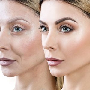 richtige Zeitpunkt für Anti-Aging